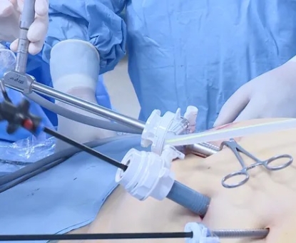 Phẫu thuật thu nhỏ dạ dày khác gì với các phương pháp phẫu thuật béo phì khác?